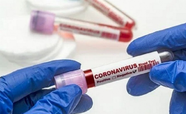 Koronavirüs'e 212 kurban daha