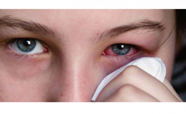 Gözlerinizi enfeksiyonlara karşı koruyun