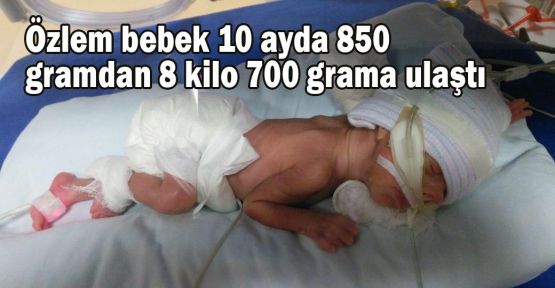 Özlem bebek 10 ayda 850 gramdan 8 kilo 700 grama ulaştı
